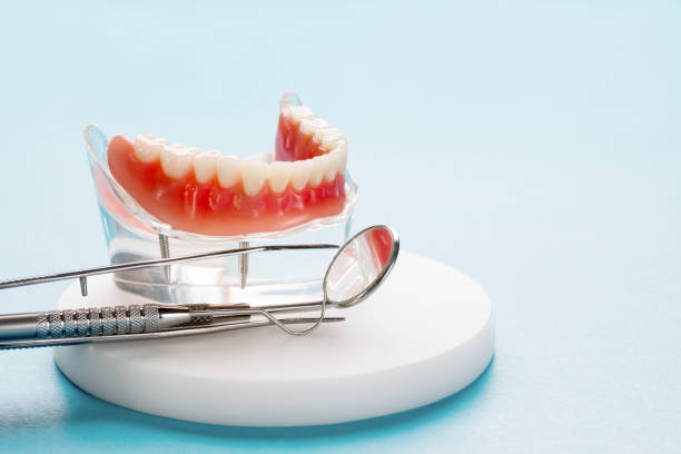 Dental Inlays and Onlays in Bridgeport, TX