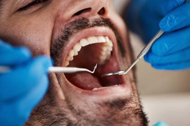 Best Preventive Dentistry  in Bridgeport, TX